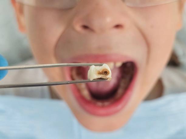 Best Urgent Tooth Repair  in Grosse Pointe, MI